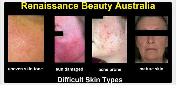 renaissanc_beauty_asp-2